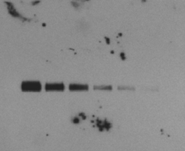 A blot with a speckled background – Western Blot Doctor - Background Issues