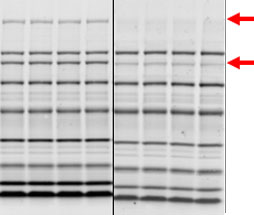 An under-transferred blot – Western Blot Doctor - Protein Transfer Issues