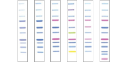 Recombinant Protein Ladders