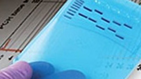 PCR and Real-Time PCR Kits​