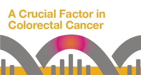 A Crucial Factor in Colorectal Cancer