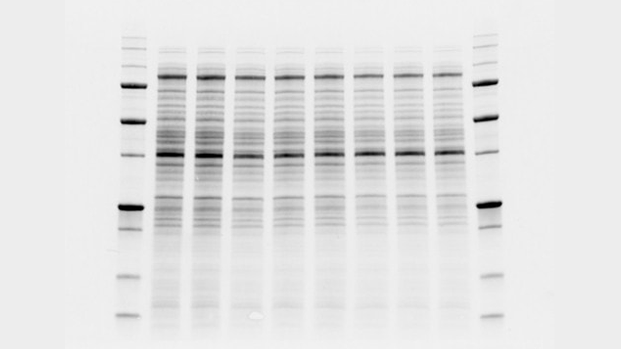 Western Blotting Normalization