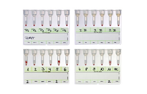 Coombs Anti-IgG | Bio-Rad