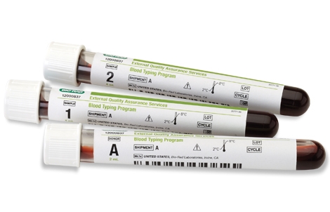 EQAS Blood Typing Program | Bio-Rad