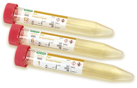 EQAS Urinalysis Program | Bio-Rad