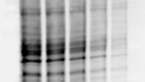 Western Blotting Total Protein Normalization