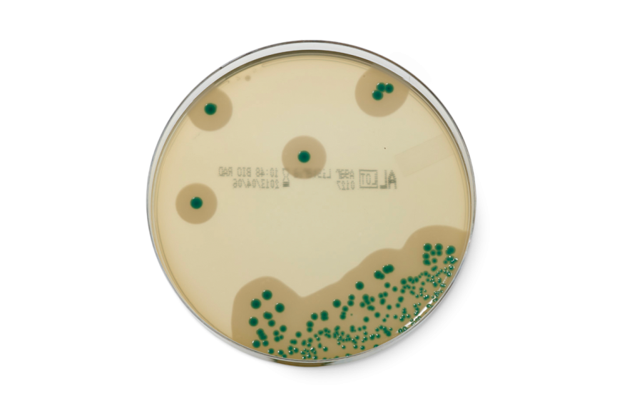 Listeria Milieu De Vie _ Listeria Monocytogenes Danger – LTEOR