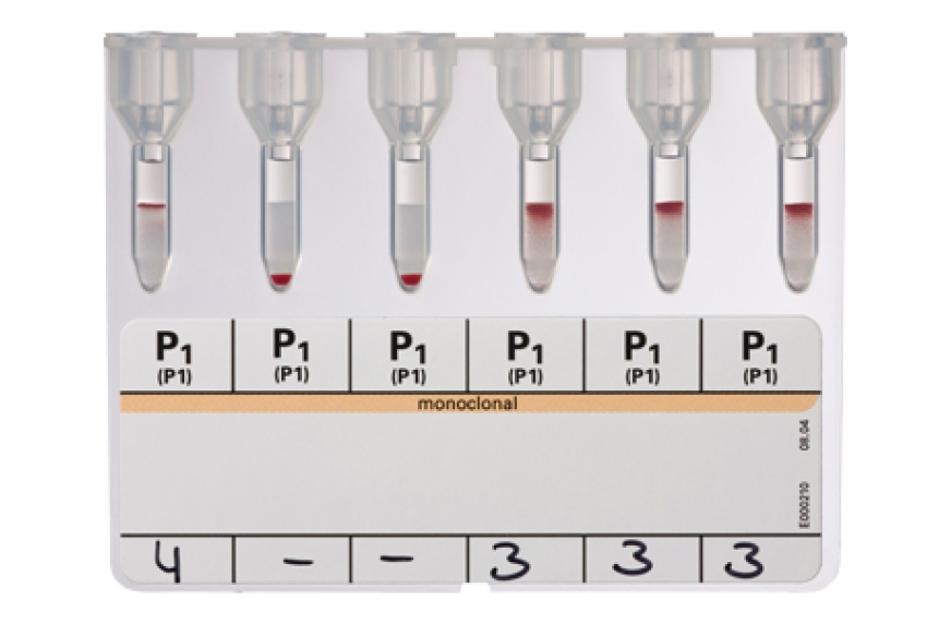 DiaClon Anti-P1