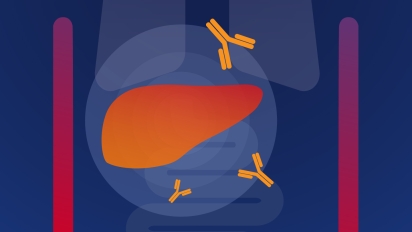 Autoimmune Disease Panel — Bio-Rad