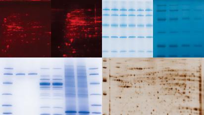 Run, Detect, Image & Quantify Proteins with Confidence