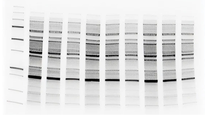Black and white image of a DNA gel electrophoresis result.
