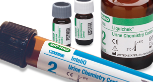 urine chemistry testing methods