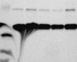 Skewed, distorted protein bands on a western blot image