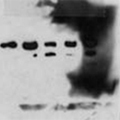A blot with a blotchy background – Western Blot Doctor - Background Issues