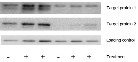 Western blot with varying levels of control proteins – Western Blotting Doctor - Loading Control Issues