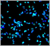 HeLa cells fixed in 3% PFA, permeabilized with 0.3% Triton X-100, and stained with mouse anti-Lamin A/C antibody (green) and counterstained with DAPI (blue).