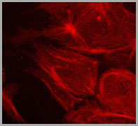 F-actin stained with Texas Red in BPAE cells.
