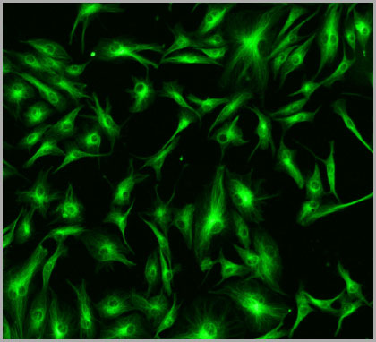 Microtubules labeled with mouse anti-bovine ?-tubulin monoclonal antibody in conjunction with BODIPY FL Goat Anti-Mouse IgG in BPAE cells.