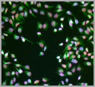 HeLa cells were fixed in 3% PFA, permeabilized with 0.3% Triton X-100 and stained with rabbit anti-tubulin alpha 1B antibody (green), mouse anti-Lamin A/C antibody (orange/red) and counterstained with DAPI (blue).