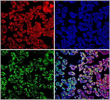 Human placenta cells on paraffin – pretreated for heat-induced epitope retrieval (HIER) using citrate pH 6 and blocked with 10% FCS – stained with goat anti-Notch 3 antibody with donkey anti-sheep/goat IgG:DyLight 549 (red) secondary antibody, mouse anti-CD34 antibody with rabbit anti-mouse IgG:DyLight 488 secondary antibody (green), and DAPI (blue).